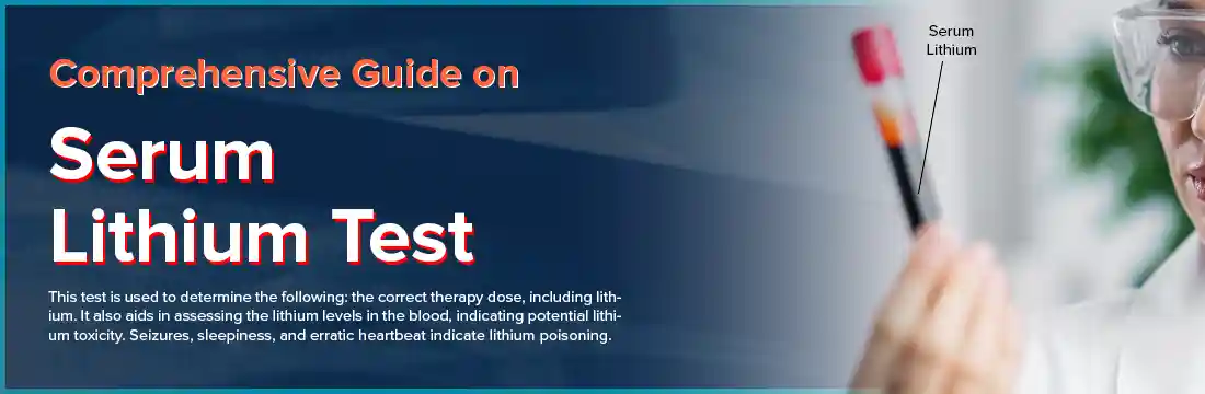 Comprehensive Guide on Serum Lithium Test